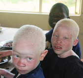 Albino children